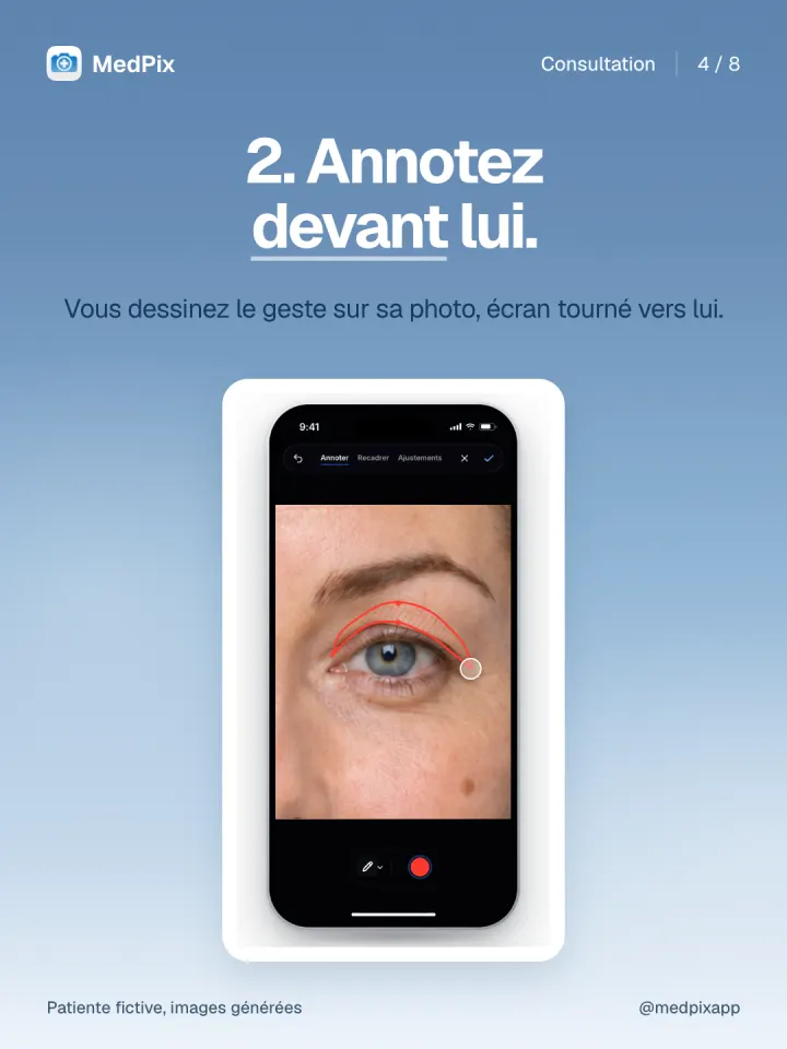 Un tracé dessiné sur la paupière de la patiente, sur sa photo.