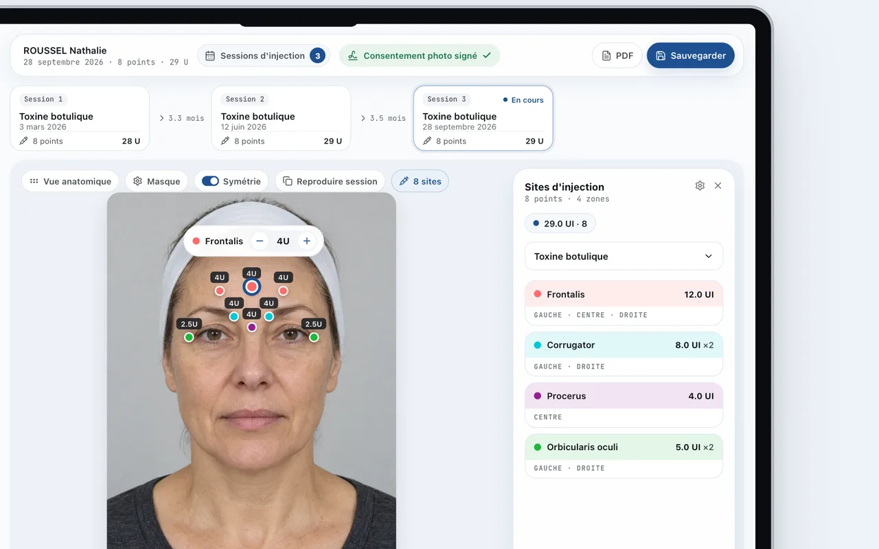 Module Inject de MedPix : points d'injection, produits et doses placés sur la photo du visage.