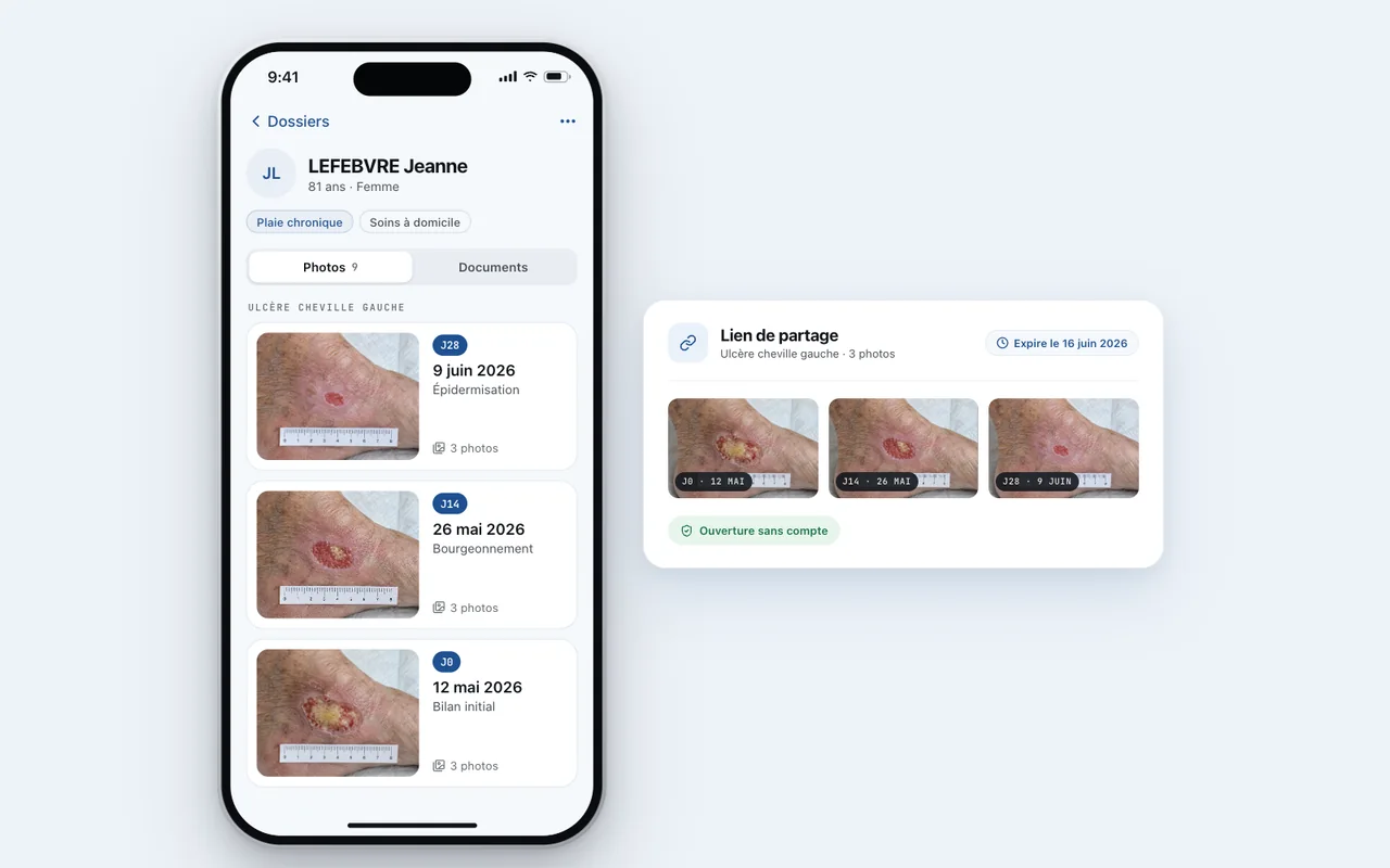 Dossier MedPix d'une patiente avec la même plaie de cheville photographiée à J0, J14 et J28, et un lien sécurisé envoyé au médecin traitant.
