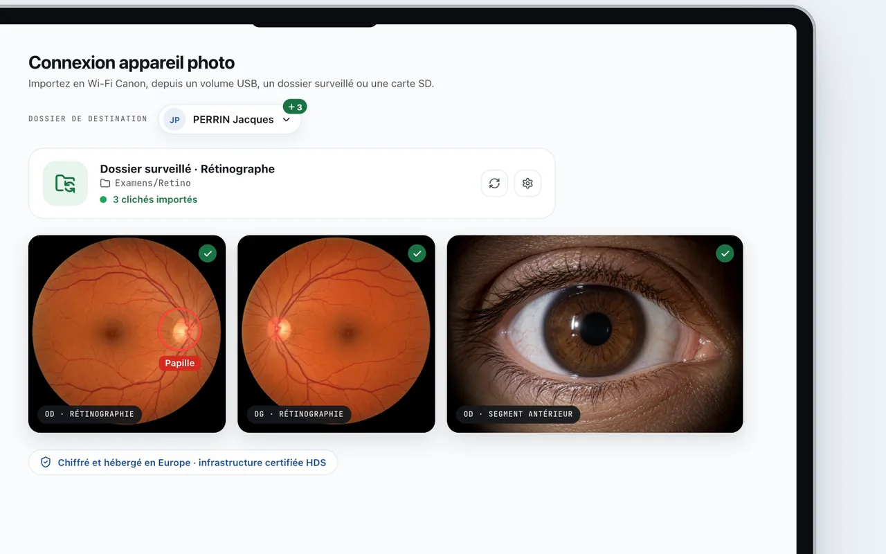 Rétinographies et photo du segment antérieur importées dans MedPix depuis un rétinographe, avec la papille annotée.