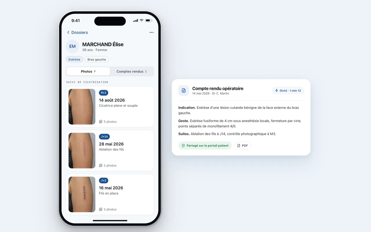 Dossier MedPix sur iPhone avec la cicatrice photographiée à J+2, J+14 et M+3, et le compte rendu opératoire dicté.